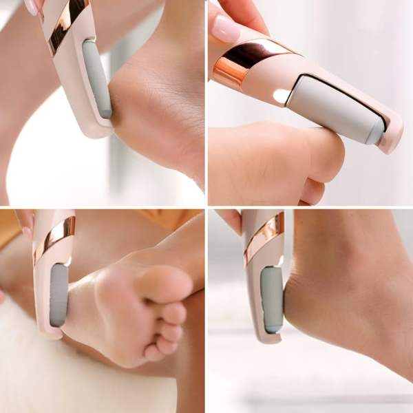 Electric Foot Sharpner | File Grinder Foot Pedicure Dead Skin Callus Remover Machine